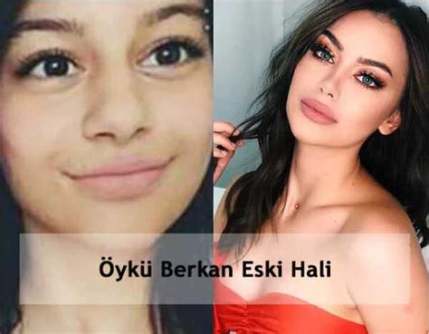öykü berkan estetiksiz hali